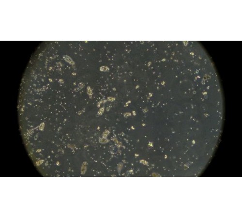 Вода из лесного озера под микроскопом MAGUS Bio V350