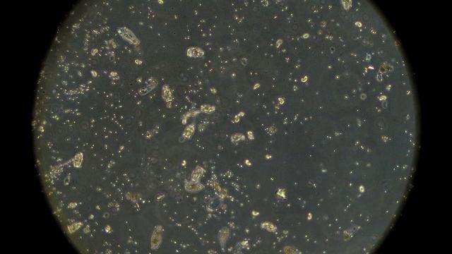 Вода из лесного озера под микроскопом MAGUS Bio V350