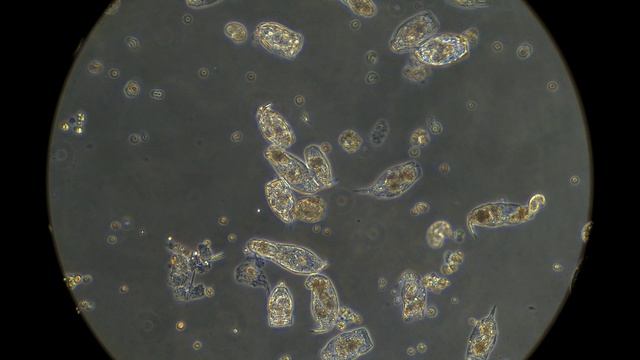 Вода из лесного озера под микроскопом MAGUS Bio V360