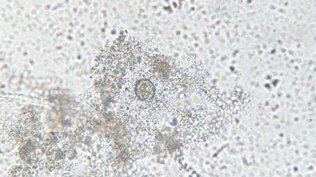 Вода из вазы под микроскопом MAGUS Bio V300